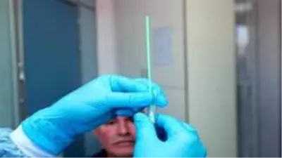 Azerbaycan'da bir günde tespit edilen vaka sayısında rekor