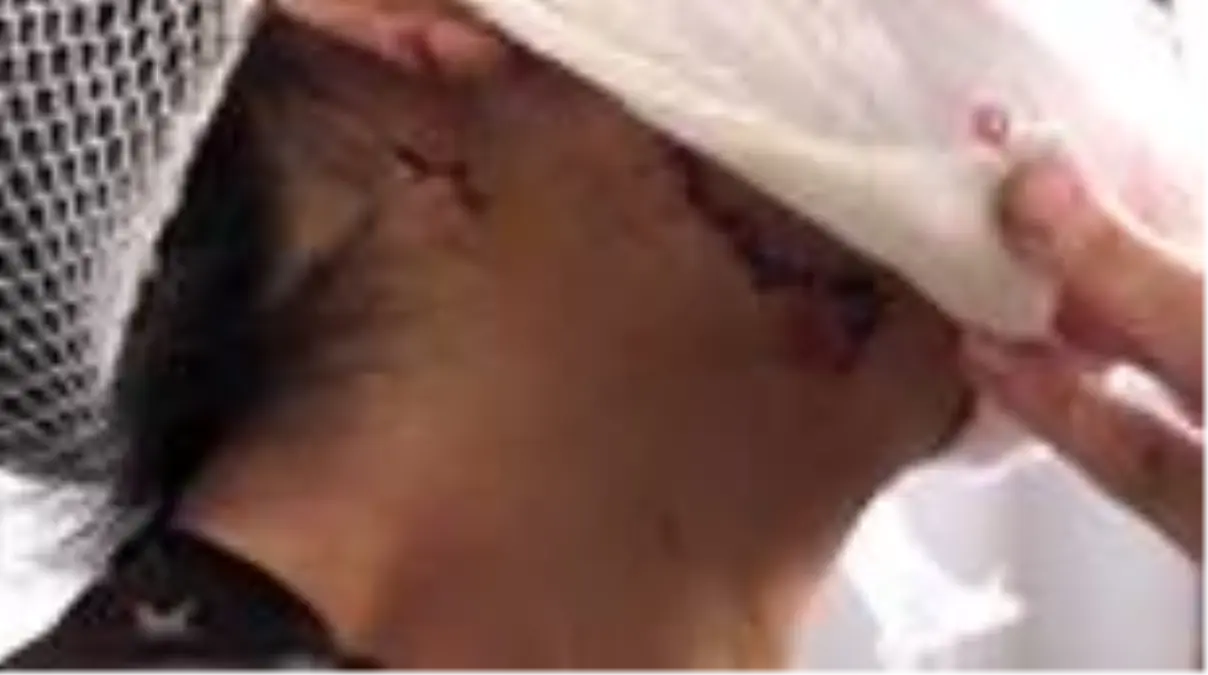 Koca şiddeti yüzünü paramparça etti, ölümden kıl payı kurtuldu