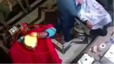 Kendisini sterilize etmeye çalışan adam, başını yaktı Kendisini sterilize etmeye çalışan adam, başını yaktı