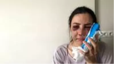 Boşanma aşamasında olduğu eşini darbeden şüpheli tutuklandı Boşanma aşamasında olduğu eşini darbeden şüpheli tutuklandı