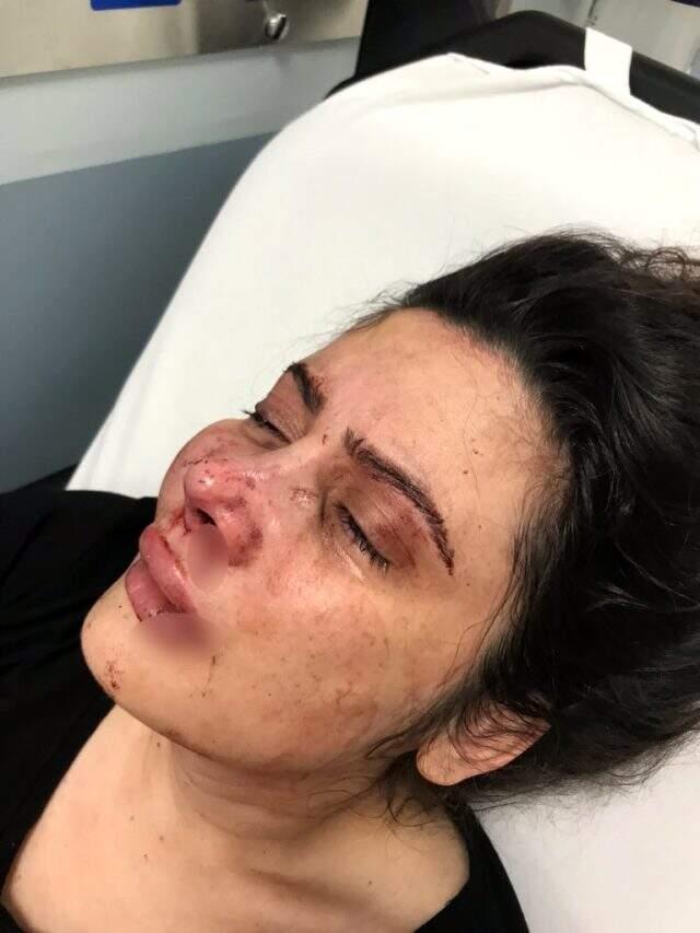 Genç kız, öldüresiye dövülen annesi için yardım istedi: Bizi babamdan kurtarın Genç kız, öldüresiye dövülen annesi için yardım istedi: Bizi babamdan kurtarın