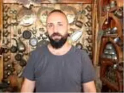 Antalyalı siyam ikizleri, İngiltere'de ayrıldı (2) Antalyalı siyam ikizleri, İngiltere'de ayrıldı (2)