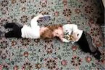Siyam ikizleri, başarılı ameliyatın ardından Türkiye'ye dönecek Siyam ikizleri, başarılı ameliyatın ardından Türkiye'ye dönecek