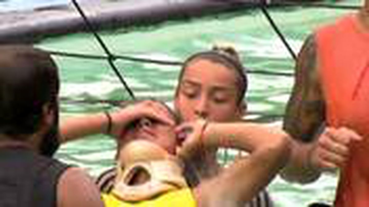Survivor'da sakatlanan Elif diskalifiye mi olacak? Acun canlı yayında yanıtladı