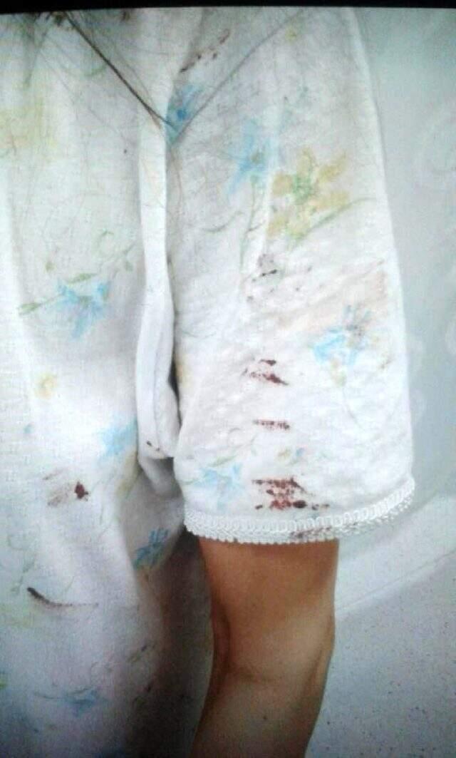 Hekim abisinin öldüresiye darbettiği kadın, dehşet anlarını anlattı Hekim abisinin öldüresiye darbettiği kadın, dehşet anlarını anlattı