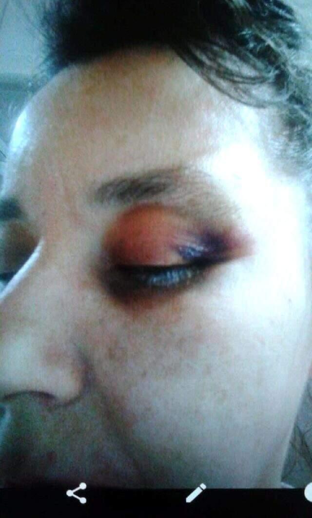 Hekim abisinin öldüresiye darbettiği kadın, dehşet anlarını anlattı Hekim abisinin öldüresiye darbettiği kadın, dehşet anlarını anlattı