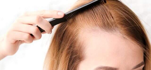 Saç dökülmesini engelleyen yöntemler