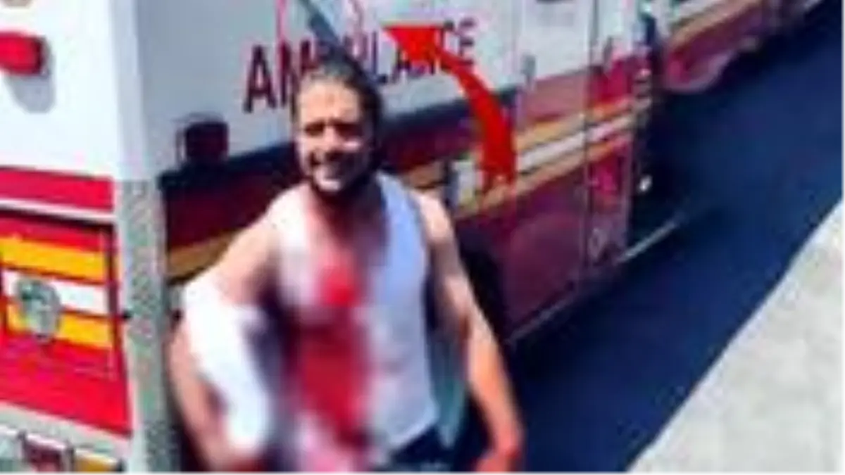 Dünya bu adamı konuşuyor! Kafasına saplı bıçakla sergilediği sakin tavırlar gündeme oturdu