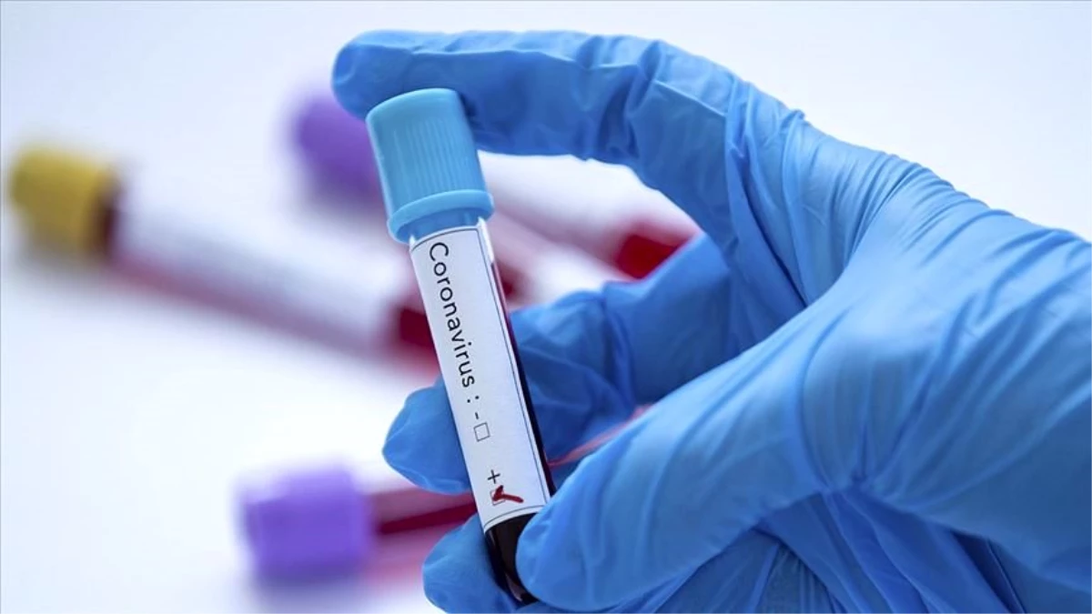 PCR testi nedir? PCR testi nasıl yapılır? PCR testi bağışıklık oranı sonucu  kaç? - Haberler