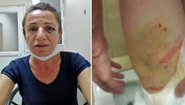 Diyarbakır Valiliği, terör şüphelisine 'köpekle işkence yapıldı' iddialarını yalanladı Diyarbakır Valiliği, terör şüphelisine 'köpekle işkence yapıldı' iddialarını yalanladı