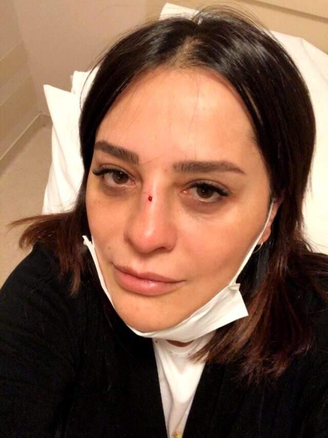 Ünlü şarkıcı Reyhan Karaca, talihsiz bir kaça geçirdi Ünlü şarkıcı Reyhan Karaca, talihsiz bir kaça geçirdi