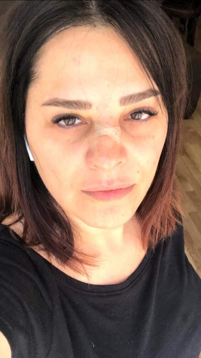 Ünlü şarkıcı Reyhan Karaca, talihsiz bir kaça geçirdi Ünlü şarkıcı Reyhan Karaca, talihsiz bir kaça geçirdi