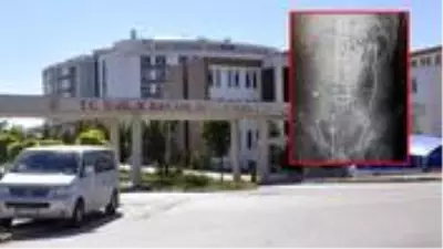 Karın ağrısı şikayetiyle hastaneye giden gencin vücudundan soda şişesi çıktı Karın ağrısı şikayetiyle hastaneye giden gencin vücudundan soda şişesi çıktı