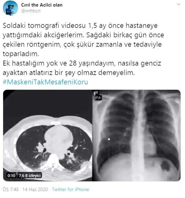 Koronavirüse yakalanan doktor gençleri nasıl uyardı? Koronaya yakalanan doktor ne yaptı? Koronavirüse yakalanan doktor gençleri nasıl uyardı? Koronaya yakalanan doktor ne yaptı?