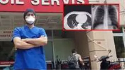Koronaya yakalanan doktor, tomografi görüntüsüyle gençleri uyardı Koronaya yakalanan doktor, tomografi görüntüsüyle gençleri uyardı