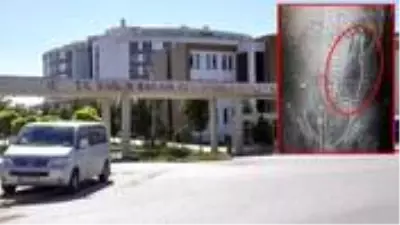 Vücudundan şişe çıkan genç konuştu: Duş alırken yanlışlıkla oldu Vücudundan şişe çıkan genç konuştu: Duş alırken yanlışlıkla oldu