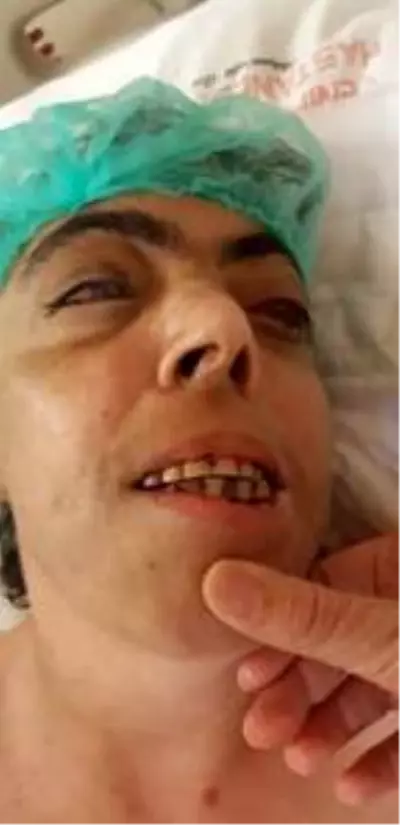 Zihinsel engelli kadına özel bakım merkezinde işkence: Gözlerini oymuşlar