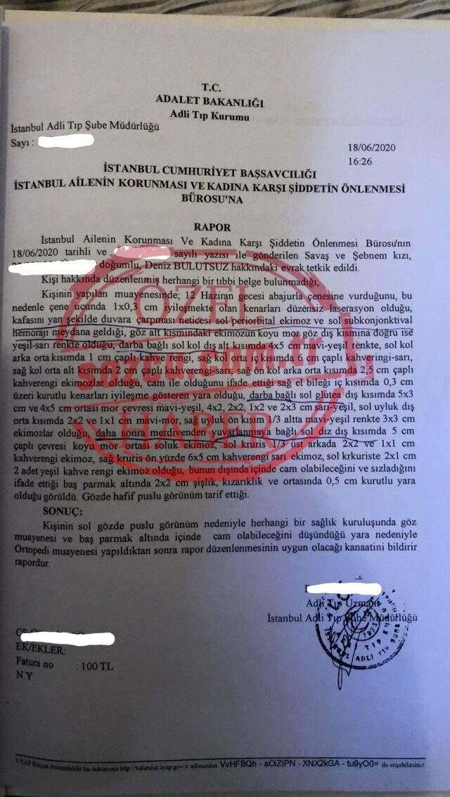 Ozan Güven'den şiddet gördüğünü iddia eden Deniz Mutlutsuz'un darp raporunda onlarca morluk ve çürük tespit edildi Ozan Güven'den şiddet gördüğünü iddia eden Deniz Mutlutsuz'un darp raporunda onlarca morluk ve çürük tespit edildi