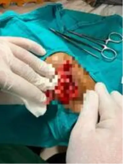 Temizlik işçisi çöp toplarken yaralandı, başkan tepki gösterdi Temizlik işçisi çöp toplarken yaralandı, başkan tepki gösterdi