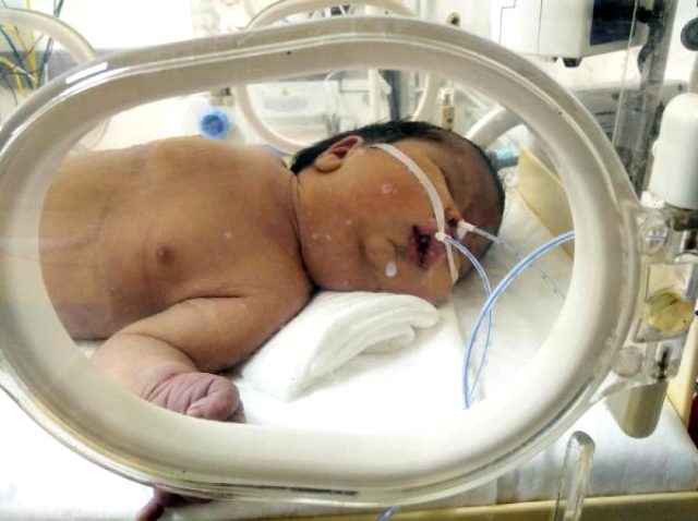 Doğum raporunda erkek olan bebek kız çıktı; aile hastaneden şikayetçi oldu