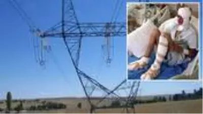 Elektrik akımına kapılan 13 yaşındaki çocuğun ayak tabanları patladı Elektrik akımına kapılan 13 yaşındaki çocuğun ayak tabanları patladı
