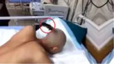 Kafasına bıçak saplanmış yaralının gösterdiği sakin tavırlar görenleri şaşırttı Kafasına bıçak saplanmış yaralının gösterdiği sakin tavırlar görenleri şaşırttı