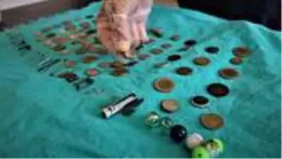 Çocukların midesinden çıkan onlarca yabancı cisim şaşırttı Çocukların midesinden çıkan onlarca yabancı cisim şaşırttı