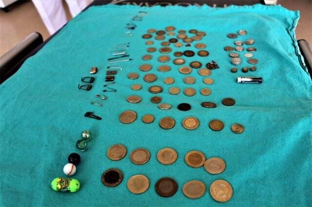 Çocukların midesinden çıkan onlarca yabancı cisim şaşırttı Çocukların midesinden çıkan onlarca yabancı cisim şaşırttı