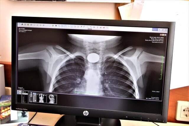 Çocukların midesinden çıkanlar şok etti!