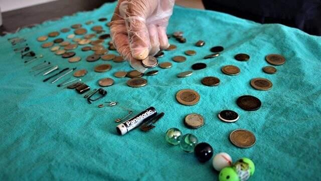 Çocukların midesinden çıkanlar şok etti!