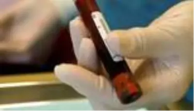 Kanser önceden tespit edilebilecek mi? 4 yıl önceden kanser tespiti yapılabilir mi? Kanser önceden tespit edilebilecek mi? 4 yıl önceden kanser tespiti yapılabilir mi?
