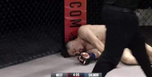 Kural dışı tekme nedeniyle tek gözünü kaybedebileceği söylenen kafes dövüşçüsü, son halini sosyal medyadan paylaştı