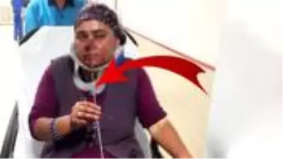 Hayvanlarını kontrol etmek için ahıra giren kadının burnuna şiş saplandı Hayvanlarını kontrol etmek için ahıra giren kadının burnuna şiş saplandı