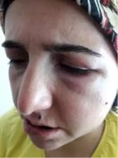 22 yıldır eşinden şiddet gören çaresiz kadın: Kendimden çok çocuklarıma zarar vermesinden korkuyorum 22 yıldır eşinden şiddet gören çaresiz kadın: Kendimden çok çocuklarıma zarar vermesinden korkuyorum