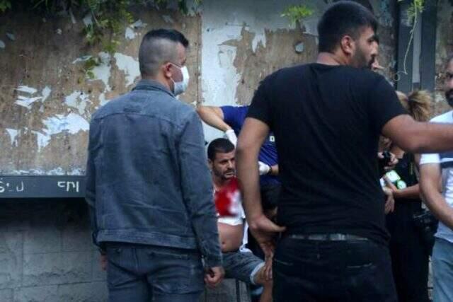 TAKSİM'DE DEĞNEKÇİ TERÖRÜ TAKSİM'DE DEĞNEKÇİ TERÖRÜ