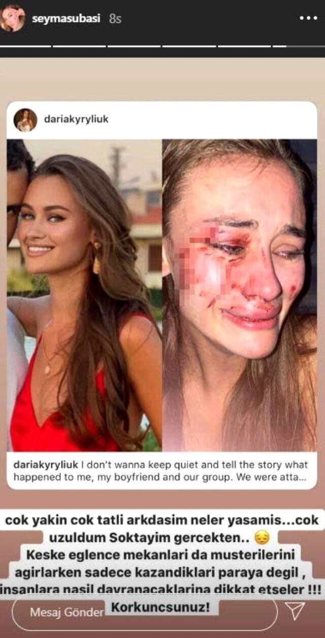 Günün iddiası: Şeyma Subaşı'nın model arkadaşı, Türkiye'de güvenlik görevlilerin saldırısına uğradı Günün iddiası: Şeyma Subaşı'nın model arkadaşı, Türkiye'de güvenlik görevlilerin saldırısına uğradı