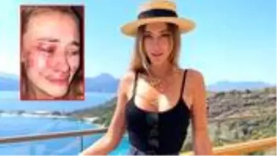 Günün iddiası: Şeyma Subaşı'nın model arkadaşı, Türkiye'de güvenlik görevlilerin saldırısına uğradı Günün iddiası: Şeyma Subaşı'nın model arkadaşı, Türkiye'de güvenlik görevlilerin saldırısına uğradı