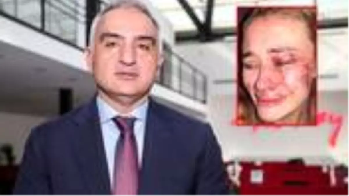 Kültür ve Turizm Bakanı Ersoy, Çeşme'de darp edilen ünlü model için bizzat devreye girdi