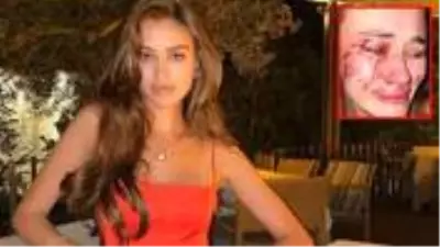 Ukraynalı model Daria Kyryliuk'u darp ettiği iddiasıyla gözaltına alınan şüpheli, serbest bırakıldı Ukraynalı model Daria Kyryliuk'u darp ettiği iddiasıyla gözaltına alınan şüpheli, serbest bırakıldı