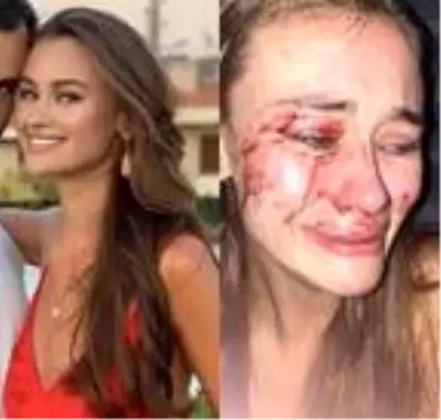 Günün iddiası: Şeyma Subaşı'nın model arkadaşı, Türkiye'de güvenlik görevlilerin saldırısına uğradı Günün iddiası: Şeyma Subaşı'nın model arkadaşı, Türkiye'de güvenlik görevlilerin saldırısına uğradı