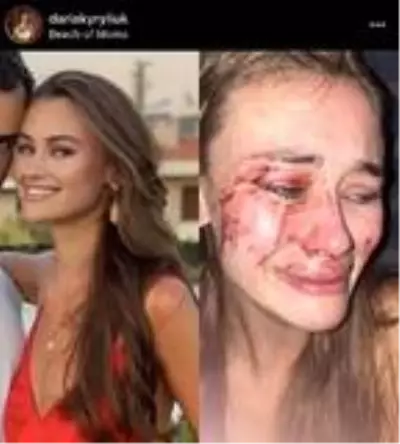 Günün iddiası: Şeyma Subaşı'nın model arkadaşı, Türkiye'de güvenlik görevlilerin saldırısına uğradı Günün iddiası: Şeyma Subaşı'nın model arkadaşı, Türkiye'de güvenlik görevlilerin saldırısına uğradı