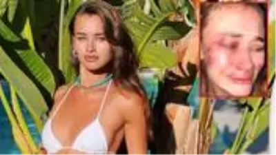 Güvenlik görevlileri tarafından darbedilen Ukraynalı model Daria Kyryliuk ilk kez konuştu Güvenlik görevlileri tarafından darbedilen Ukraynalı model Daria Kyryliuk ilk kez konuştu