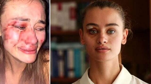 Güvenlik görevlileri tarafından darbedilen Ukraynalı model Daria Kyryliuk konuştu Güvenlik görevlileri tarafından darbedilen Ukraynalı model Daria Kyryliuk konuştu