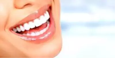 Hollywood Gülüşü Hollywood Gülüşü