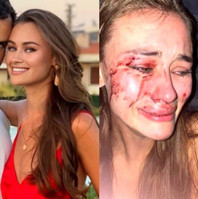 Model Daria Kyryliuk'un şiddet gördüğü olaylı gecenin görüntüleri ortaya çıktı Model Daria Kyryliuk'un şiddet gördüğü olaylı gecenin görüntüleri ortaya çıktı