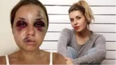 Ünlü sunucu, oğlunun gözü önünde kendisine tecavüz etmeye çalışan kişinin şiddetine maruz kaldı Ünlü sunucu, oğlunun gözü önünde kendisine tecavüz etmeye çalışan kişinin şiddetine maruz kaldı