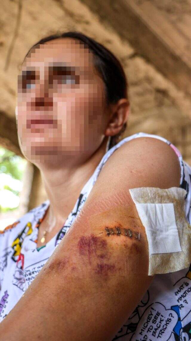 Boşanma isteğini hazmedemeyen koca, 3 çocuğunun gözleri önünde eşine saldırdı