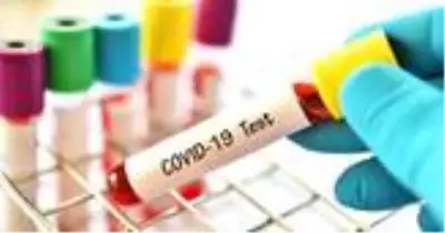 Bu virus pusuda bekliyor ve kalabalıklar endişe veriyor! Bu virus pusuda bekliyor ve kalabalıklar endişe veriyor!