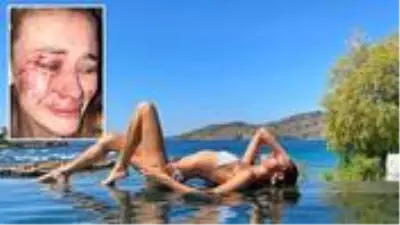 Son Dakika: Çeşme'de Ukraynalı modelin darbedilmesiyle ilgili kaymakamın görev yeri değiştirildi Son Dakika: Çeşme'de Ukraynalı modelin darbedilmesiyle ilgili kaymakamın görev yeri değiştirildi