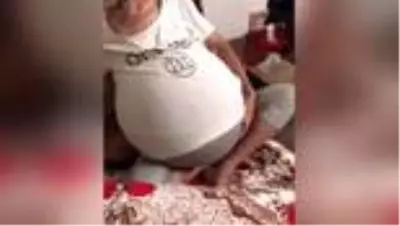 Karnında 20 kiloluk kütle taşıyan genç kadın tıp dünyasını şaşırttı Karnında 20 kiloluk kütle taşıyan genç kadın tıp dünyasını şaşırttı